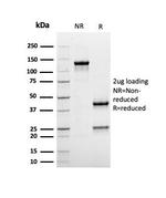 Albumin (Transport Protein) Antibody in SDS-PAGE (SDS-PAGE)
