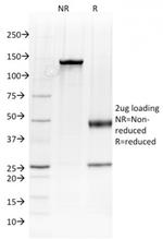 Albumin (Transport Protein) Antibody in SDS-PAGE (SDS-PAGE)