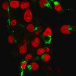 Albumin (Transport Protein) Monoclonal Antibody (ALB, 2355)