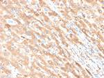 Albumin (Transport Protein) Recombinant Rabbit Monoclonal Antibody (ALB, 6411R)