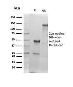 Albumin (Transport Protein) Antibody in SDS-PAGE (SDS-PAGE)