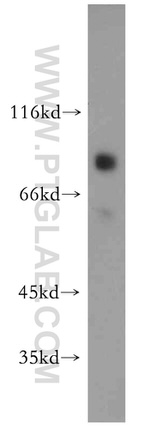 SATB2 Antibody in Western Blot (WB)