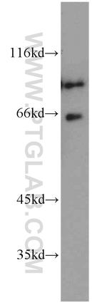 SATB2 Antibody in Western Blot (WB)