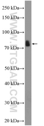 SATB2 Antibody in Western Blot (WB)
