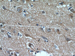 NHLRC1 Antibody in Immunohistochemistry (Paraffin) (IHC (P))