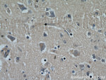 NHLRC1 Antibody in Immunohistochemistry (Paraffin) (IHC (P))