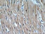 NHLRC1 Antibody in Immunohistochemistry (Paraffin) (IHC (P))