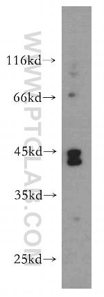 NHLRC1 Antibody in Western Blot (WB)