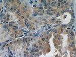 DEPDC6 Antibody in Immunohistochemistry (Paraffin) (IHC (P))