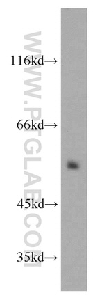 DEPDC6 Antibody in Western Blot (WB)