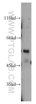 DEPDC6 Antibody in Western Blot (WB)
