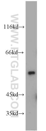 DEPDC6 Antibody in Western Blot (WB)