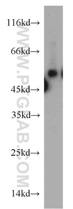 FAM124B Antibody in Western Blot (WB)