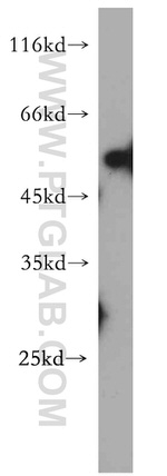 FAM124B Antibody in Western Blot (WB)