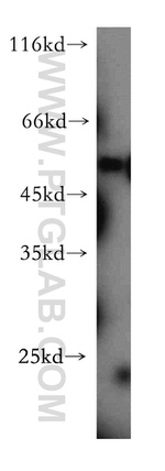 FAM124B Antibody in Western Blot (WB)