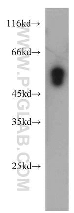 FAM124B Antibody in Western Blot (WB)