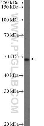 TMEM117 Antibody in Western Blot (WB)