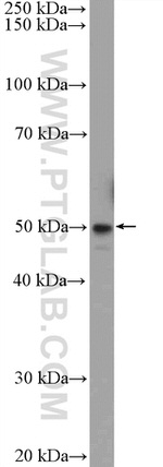 TMEM117 Antibody in Western Blot (WB)