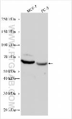 ZNF536 Antibody in Western Blot (WB)