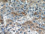 GTSE1 Antibody in Immunohistochemistry (Paraffin) (IHC (P))