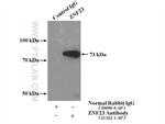 ZNF23 Antibody in Immunoprecipitation (IP)