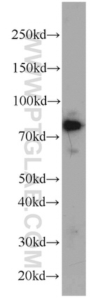 ZNF23 Antibody in Western Blot (WB)