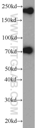 ZNF23 Antibody in Western Blot (WB)