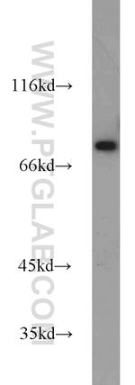 ZNF23 Antibody in Western Blot (WB)