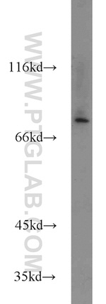 ZNF23 Antibody in Western Blot (WB)