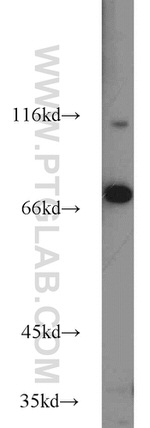 ZNF23 Antibody in Western Blot (WB)