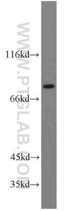ZNF23 Antibody in Western Blot (WB)
