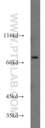 ZNF23 Antibody in Western Blot (WB)