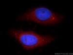 TTC39A Antibody in Immunocytochemistry (ICC/IF)