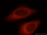 TTC39A Antibody in Immunocytochemistry (ICC/IF)