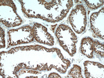 TTC39A Antibody in Immunohistochemistry (Paraffin) (IHC (P))