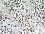 TTC39A Antibody in Immunohistochemistry (Paraffin) (IHC (P))
