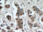 TTC39A Antibody in Immunohistochemistry (Paraffin) (IHC (P))