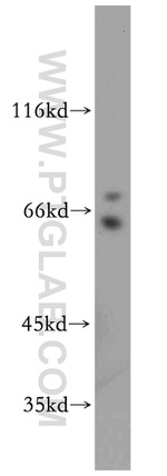 TTC39A Antibody in Western Blot (WB)