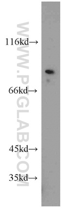 ZDHHC5 Antibody in Western Blot (WB)