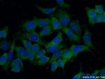 STARD13 Antibody in Immunocytochemistry (ICC/IF)