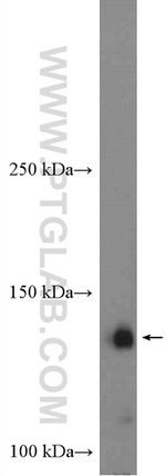 STARD13 Antibody in Western Blot (WB)