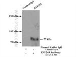 ZNF263 Antibody in Immunoprecipitation (IP)