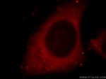 Cathepsin D Antibody in Immunocytochemistry (ICC/IF)