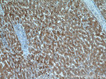 Cathepsin D Antibody in Immunohistochemistry (Paraffin) (IHC (P))
