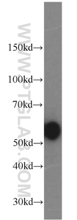 Cathepsin D Antibody in Western Blot (WB)