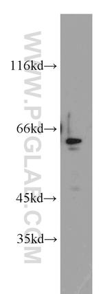ZNF671 Antibody in Western Blot (WB)
