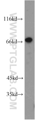 ZNF671 Antibody in Western Blot (WB)
