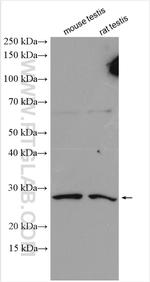 C9orf7/CACFD1 Antibody in Western Blot (WB)