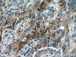 FAM129A Antibody in Immunohistochemistry (Paraffin) (IHC (P))