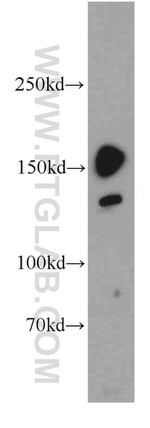 FAM129A Antibody in Western Blot (WB)